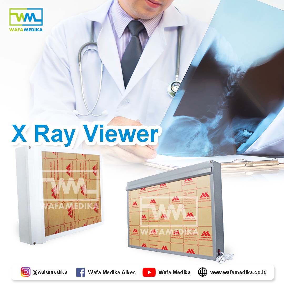 X-Ray Viewer Lampu Baca Rontgen