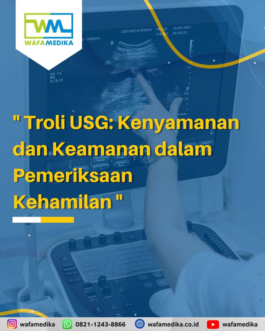 Troli USG: Kenyamanan dan Keamanan dalam Pemeriksaan Kehamilan